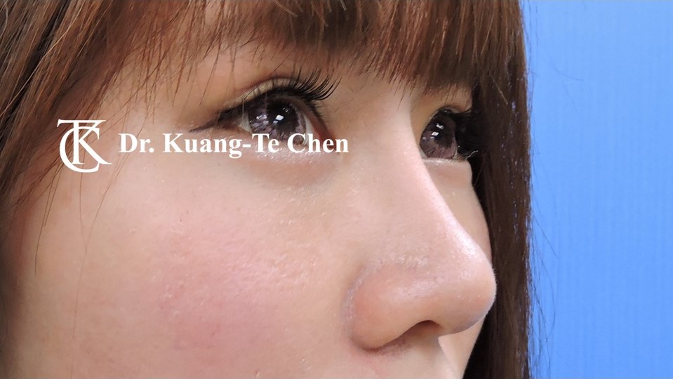 投影片18