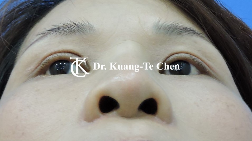 投影片4