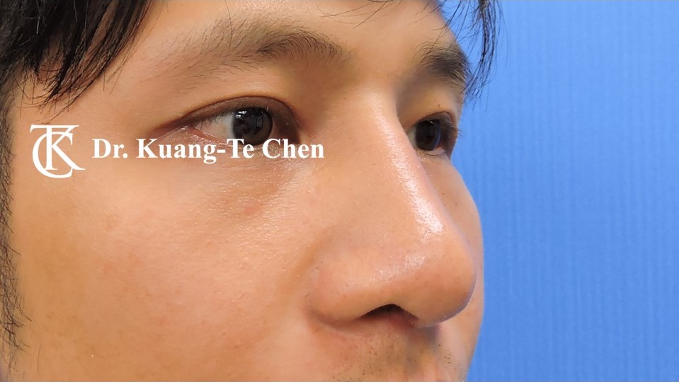 投影片6